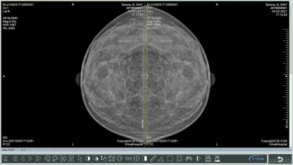 eMini PACS - Medical Healthcare Radiology X-ray Imaging System - e-Join