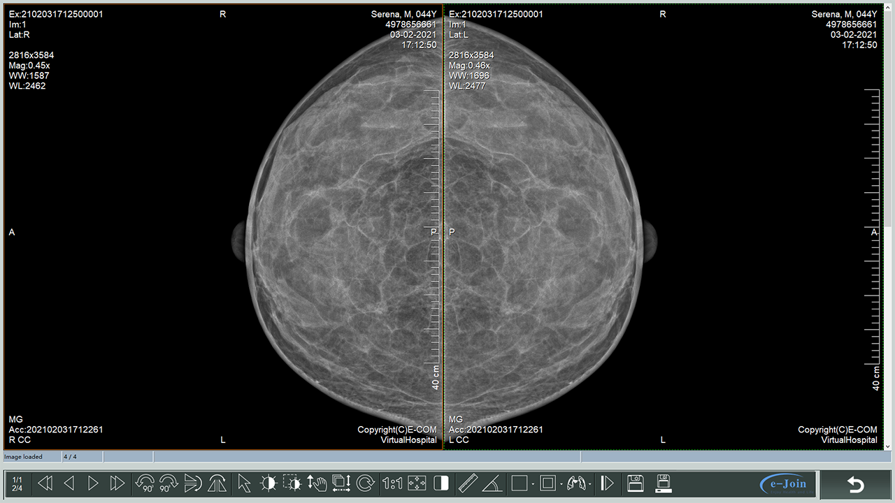 FlyViewer Add-in of eMini PACS