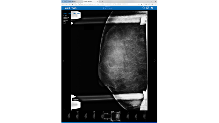 eMini PACS - Medical Healthcare Radiology X-ray Imaging System - e-Join