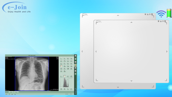 Revolutionizing Radiology: e-Join’s Wireless Flat Panel Detector for General X-ray Machines