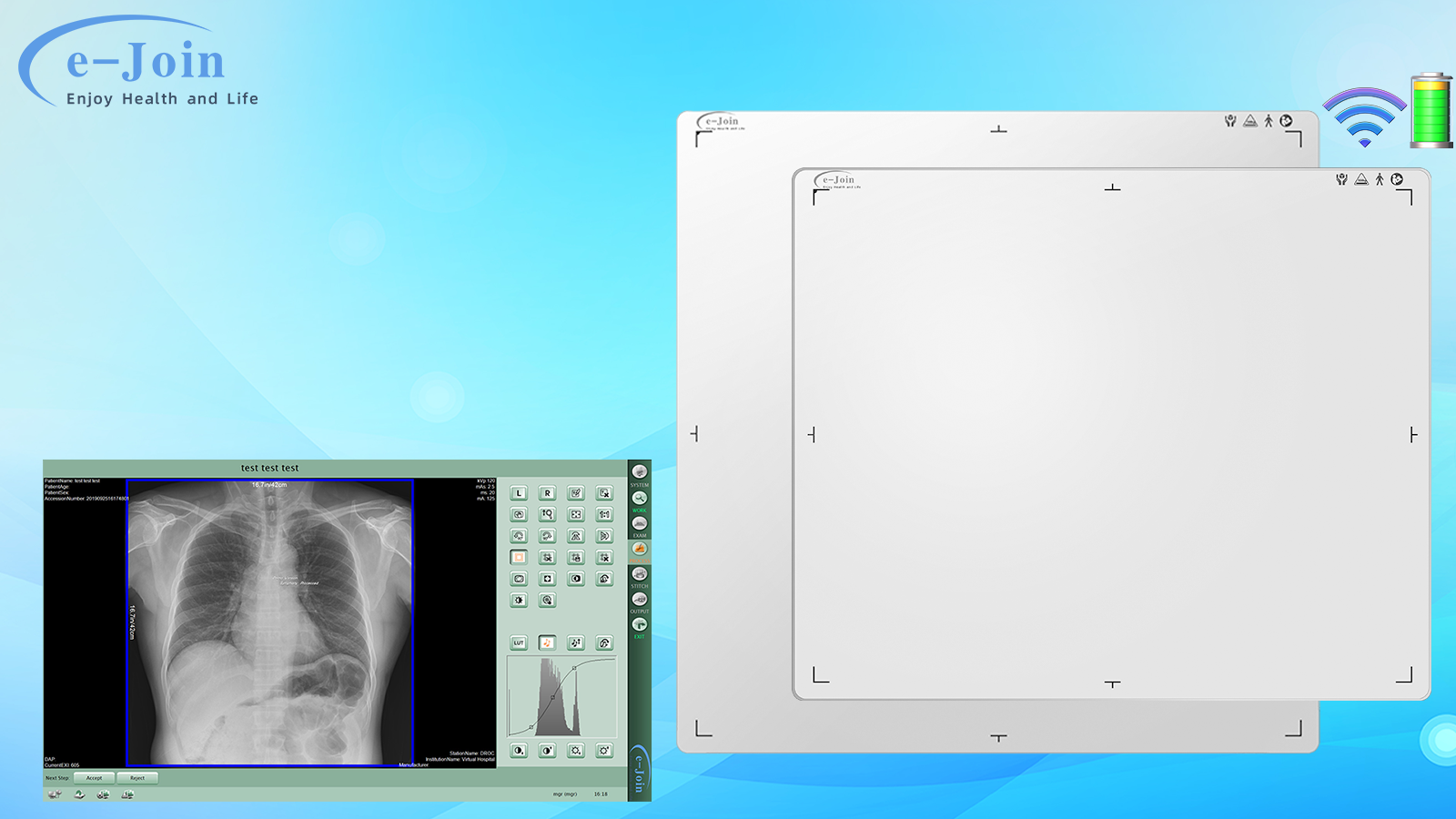 Revolutionizing Radiology: e-Join’s Wireless Flat Panel Detector for General X-ray Machines