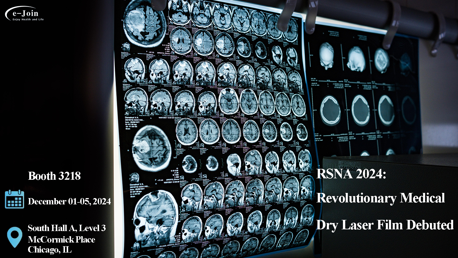Revolutionary Medical Dry Laser Film Debuted at RSNA 2024