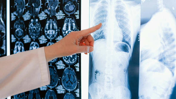 e-Join: Woman Pointing at X-ray Images