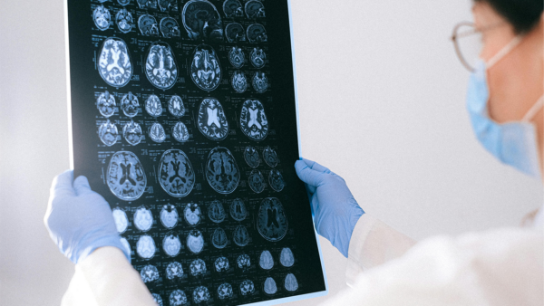 e-Join: a doctor holding MRI result of the brain
